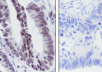 Histone H3 (Tri Methyl K36) antibody