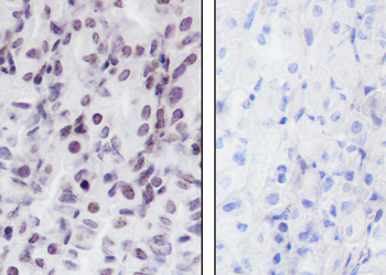 Histone H3 (Tri Methyl K36) antibody