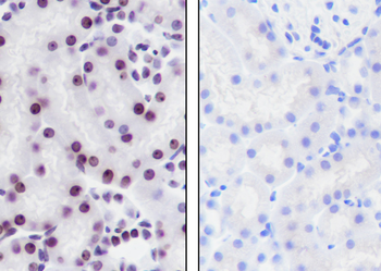 Histone H3 (Tri Methyl K36) antibody