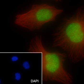 RPA32 antibody