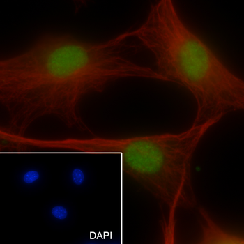 RPA32 antibody