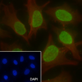 Di-Methyl-Histone H3 (Lys56) antibody