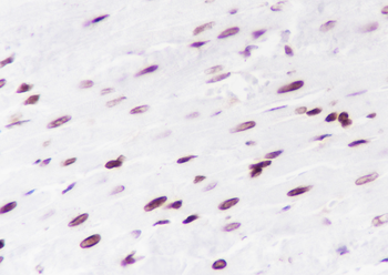 Di-Methyl-Histone H3 (Lys56) antibody