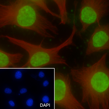 Mono-Methyl-Histone H3 (Lys36) antibody