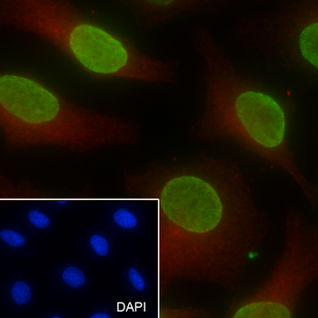 Di-Methyl-Histone H3 (Lys27) antibody