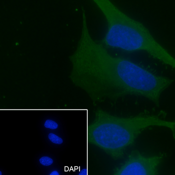 PCMT1 antibody