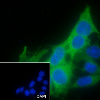 RRM2 antibody