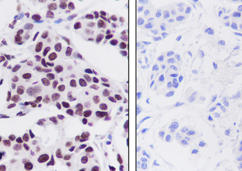 JUNB antibody