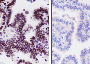 JUNB antibody