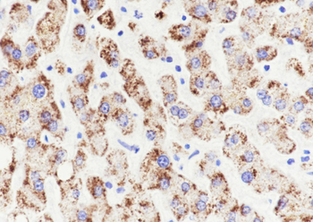 AMACR antibody