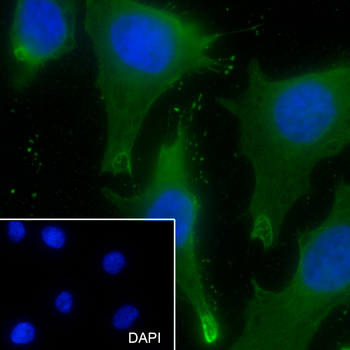 UPF1 antibody