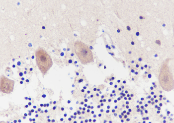 TMEM106B antibody