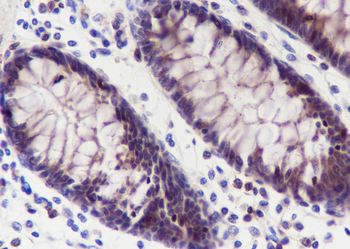 TMEM106B antibody