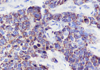 ECHS1 antibody