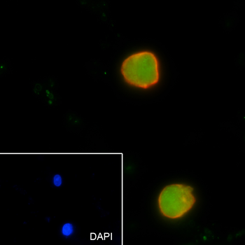 KDM4B antibody