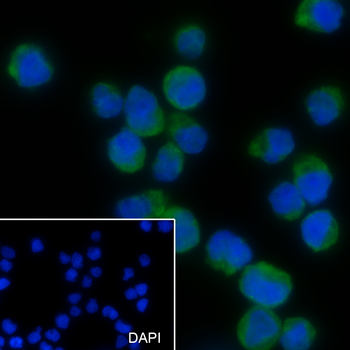 PSMB8 antibody