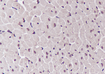 FLII antibody