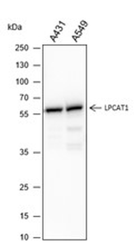 LPCAT1 antibody