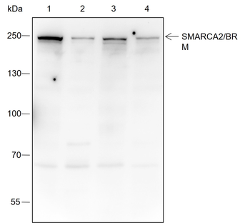 SMARCA2/BRM Recombinant Rabbit Monoclonal Antibody