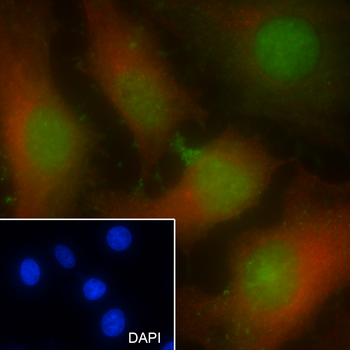 HRPT2 antibody