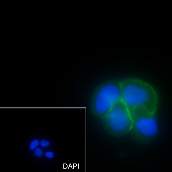 TROP2 antibody