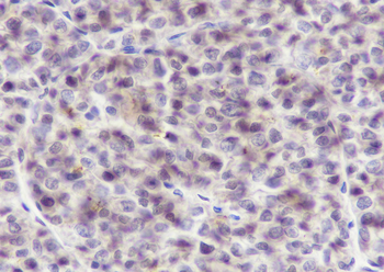 DDB1 antibody