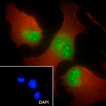 TDP-43 antibody