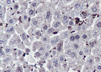 PTPN2 antibody