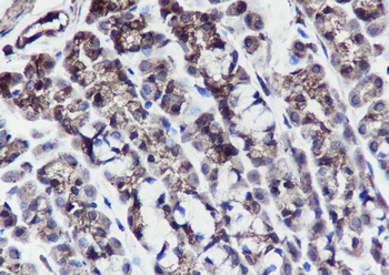 PTPN2 antibody