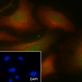 PABPN1 antibody