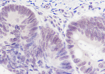 PABPN1 antibody