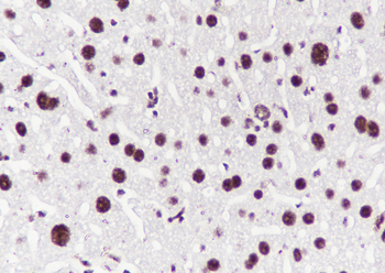 PABPN1 antibody