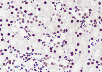 PABPN1 antibody