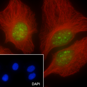 MCM5 antibody