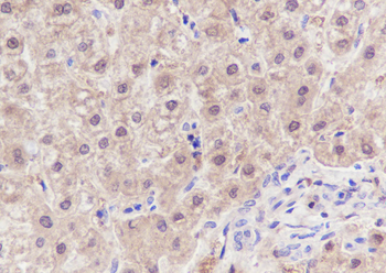 SETBP1 antibody