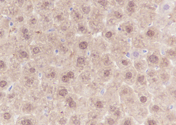 SETBP1 antibody