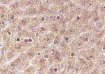 SETBP1 antibody