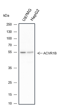 ACVR1B antibody