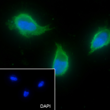 ACVR1B antibody