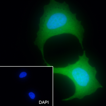 CRABP2 antibody