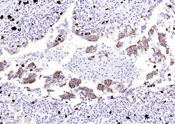 STING1 antibody