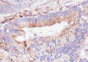 STING1 antibody