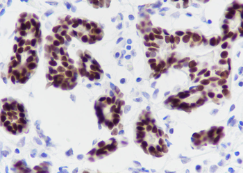 SOX10 antibody