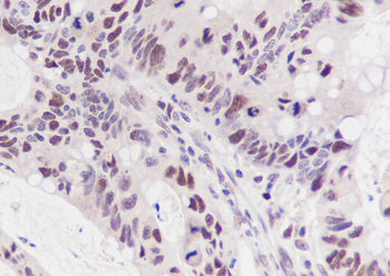 MSH6 antibody