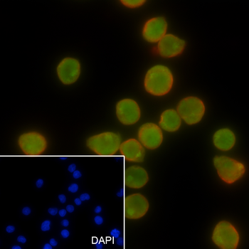 SATB1 antibody