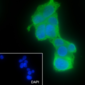 ASGPR antibody