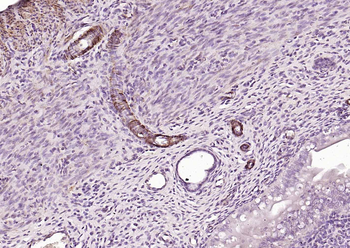 CALD1 antibody