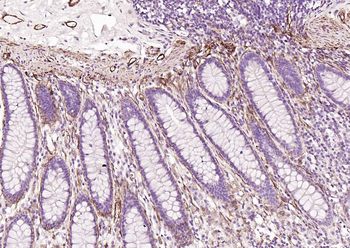 CALD1 antibody