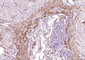 CALD1 antibody