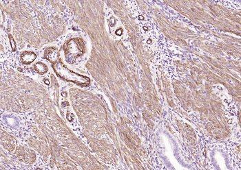 CALD1 antibody